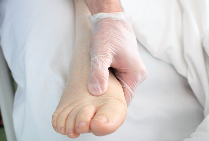 Œdème des Jambes